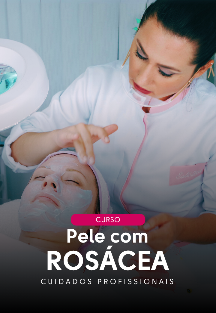 card-rosacea