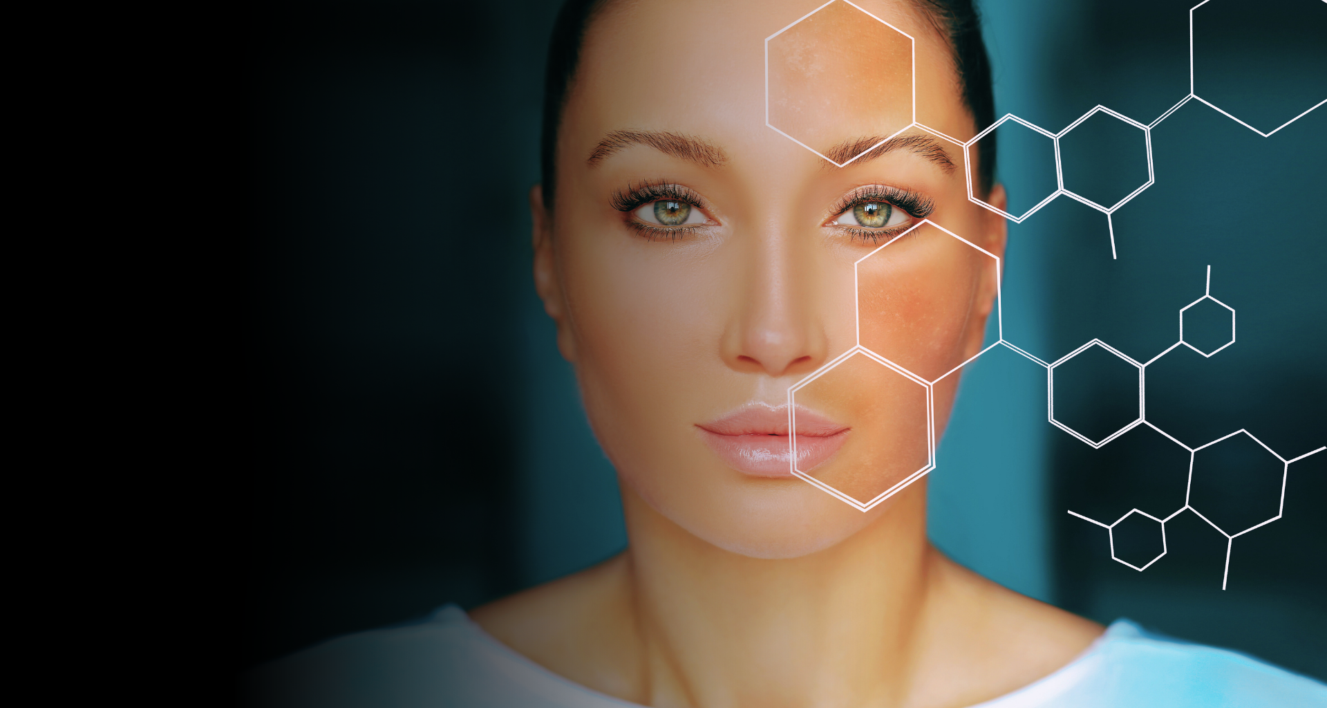 Descubra como tratar peles com melasma de maneira eficaz e sem rebotes!